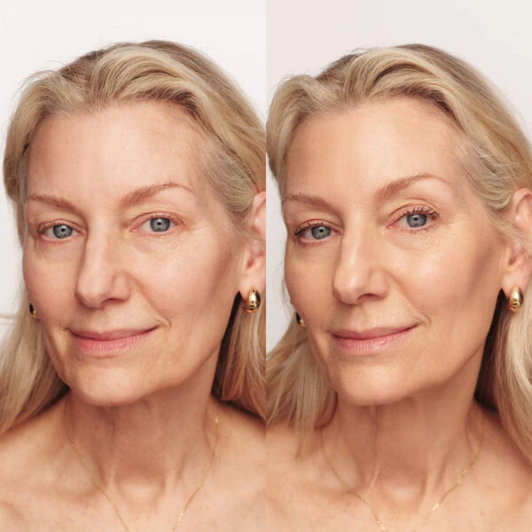 Infinite Glow - Redefine tu piel - Image 4